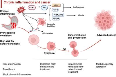 Editorial: Premalignant conditions in the esophagus and stomach